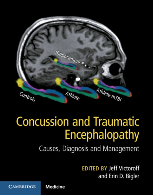 Concussion and Traumatic Encephalopathy : Causes, Diagnosis and Management, PDF eBook