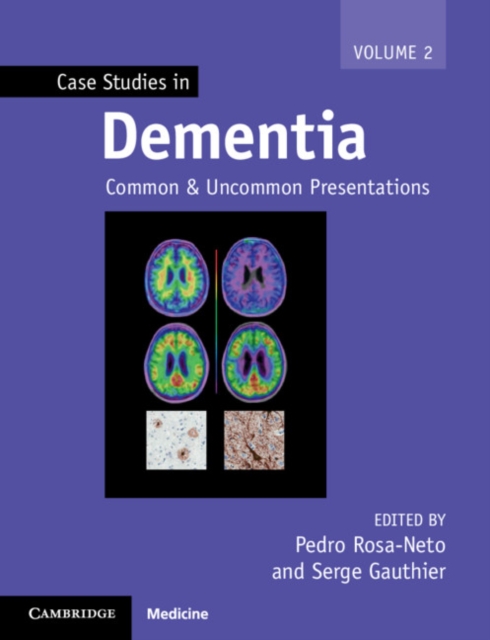 Case Studies in Dementia : Common and Uncommon Presentations, EPUB eBook