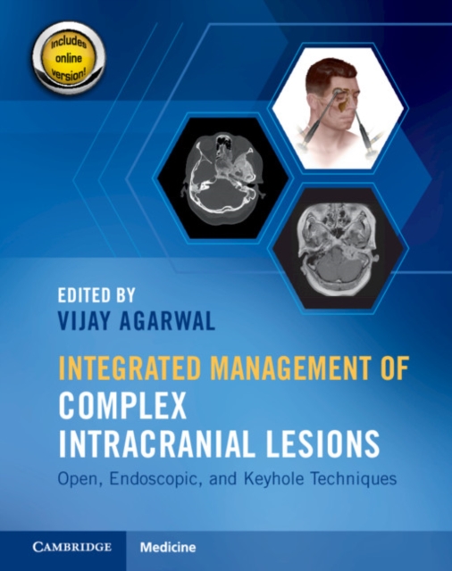 Integrated Management of Complex Intracranial Lesions Hardback Set and Static Online Product : Open, Endoscopic, and Keyhole Techniques, Multiple-component retail product Book
