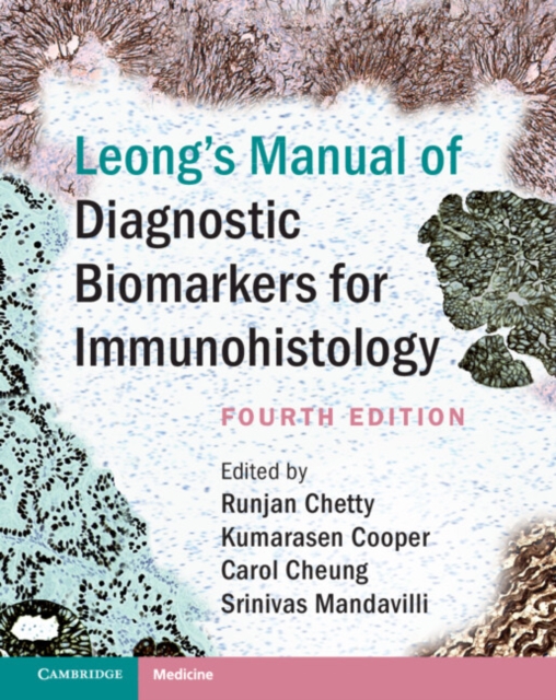 Leong's Manual of Diagnostic Biomarkers for Immunohistology, PDF eBook