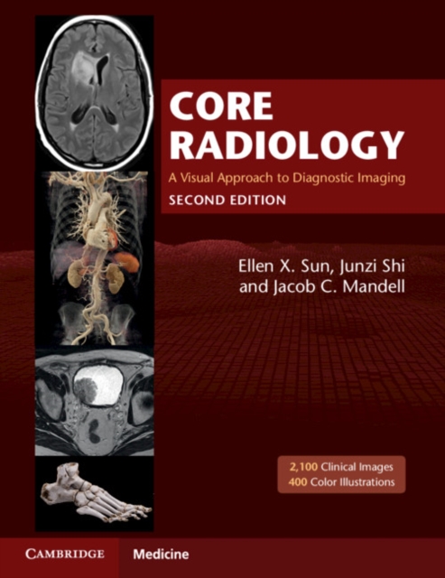Core Radiology : A Visual Approach to Diagnostic Imaging, Multiple-component retail product Book