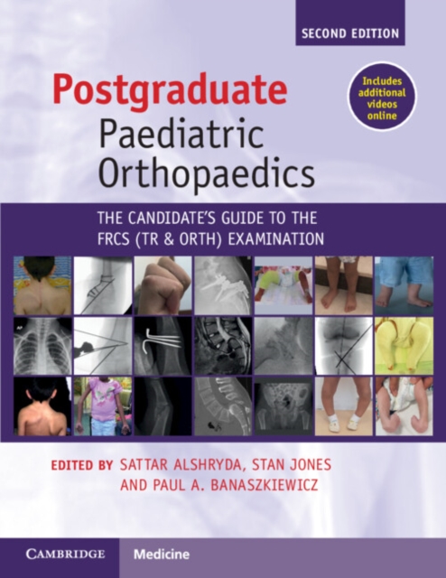 Postgraduate Paediatric Orthopaedics : The Candidate's Guide to the FRCS(Tr&Orth) Examination, Paperback / softback Book