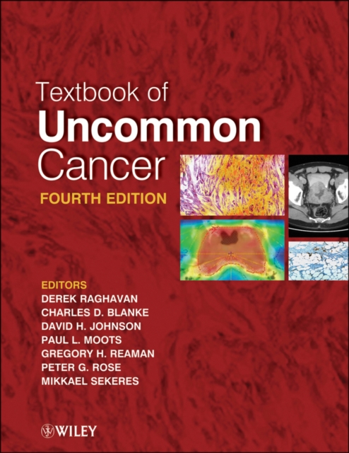 Textbook of Uncommon Cancer, Hardback Book