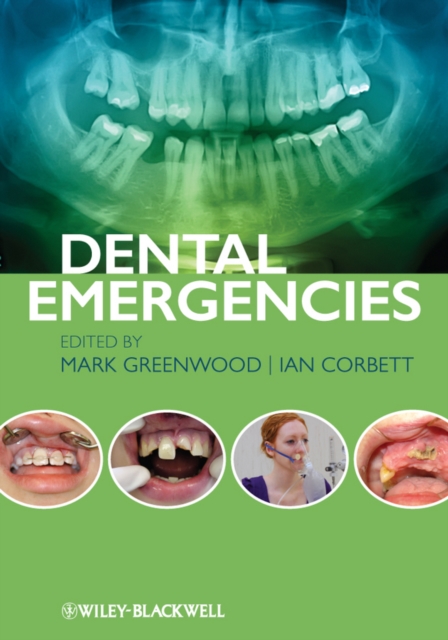 Dental Emergencies, PDF eBook