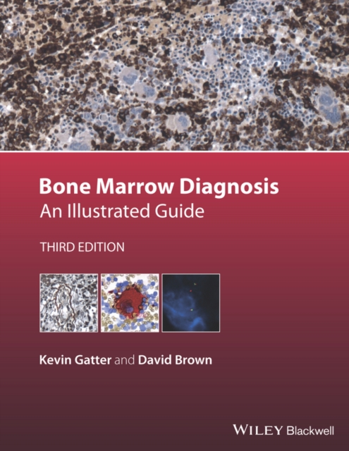 Bone Marrow Diagnosis : An Illustrated Guide, Hardback Book