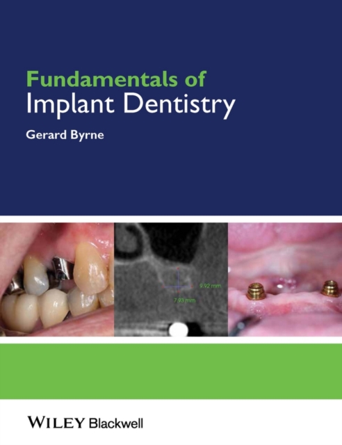 Fundamentals of Implant Dentistry, PDF eBook