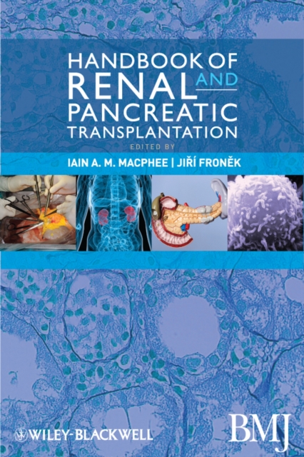 Handbook of Renal and Pancreatic Transplantation, PDF eBook