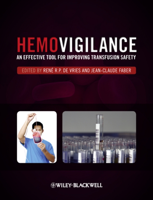 Hemovigilance : An Effective Tool for Improving Transfusion Safety, EPUB eBook