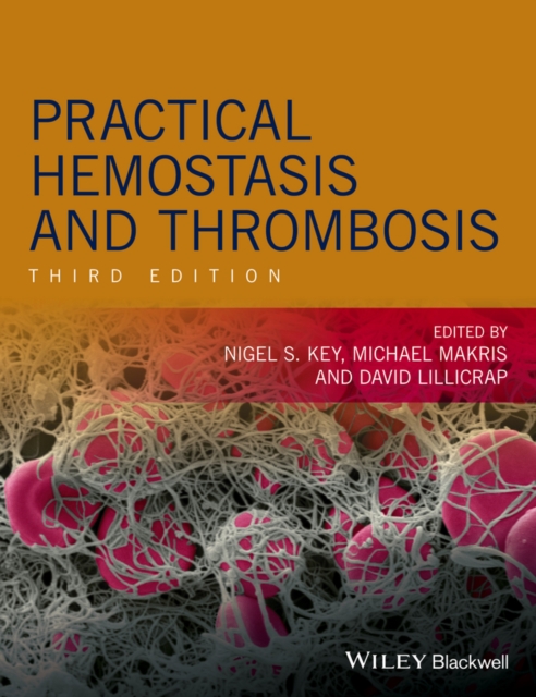 Practical Hemostasis and Thrombosis, EPUB eBook