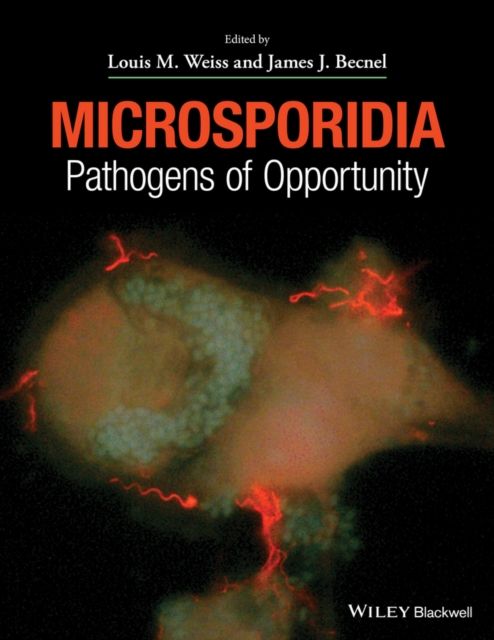 Microsporidia : Pathogens of Opportunity, Hardback Book