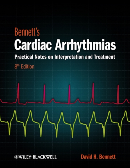 Bennett's Cardiac Arrhythmias : Practical Notes on Interpretation and Treatment, PDF eBook