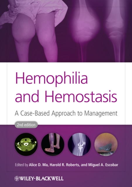 Hemophilia and Hemostasis, PDF eBook
