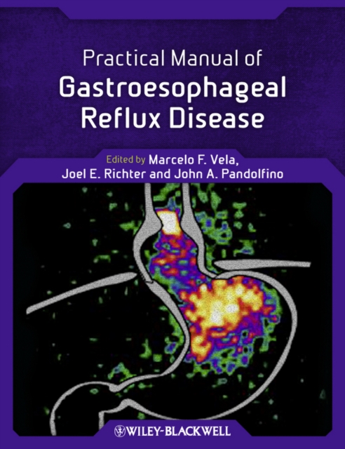 Practical Manual of Gastroesophageal Reflux Disease, PDF eBook