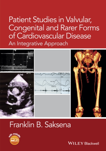 Patient Studies in Valvular, Congenital, and Rarer Forms of Cardiovascular Disease : An Integrative Approach, PDF eBook