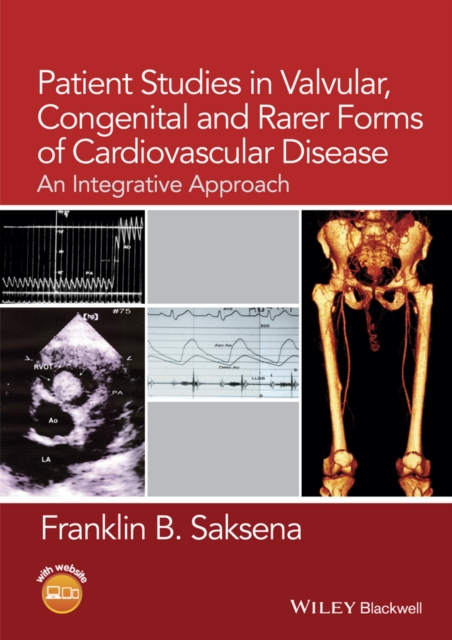 Patient Studies in Valvular, Congenital, and Rarer Forms of Cardiovascular Disease : An Integrative Approach, Paperback / softback Book