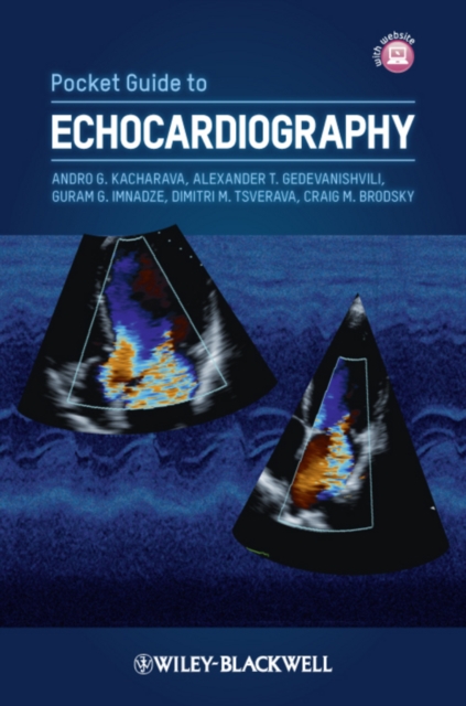Pocket Guide to Echocardiography, PDF eBook