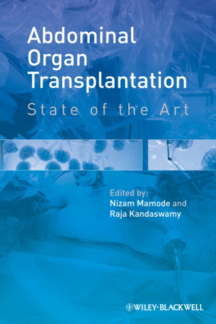 Abdominal Organ Transplantation : State of the Art, EPUB eBook
