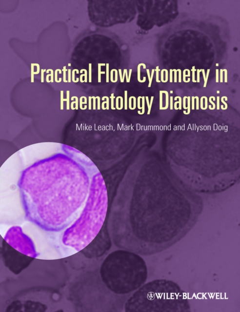 Practical Flow Cytometry in Haematology Diagnosis, EPUB eBook