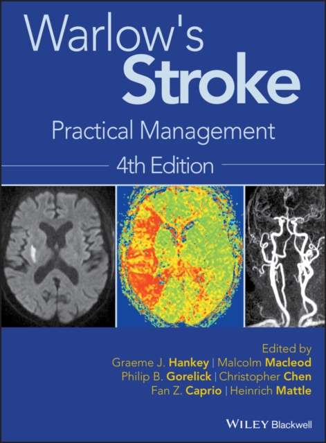 Warlow's Stroke : Practical Management, EPUB eBook