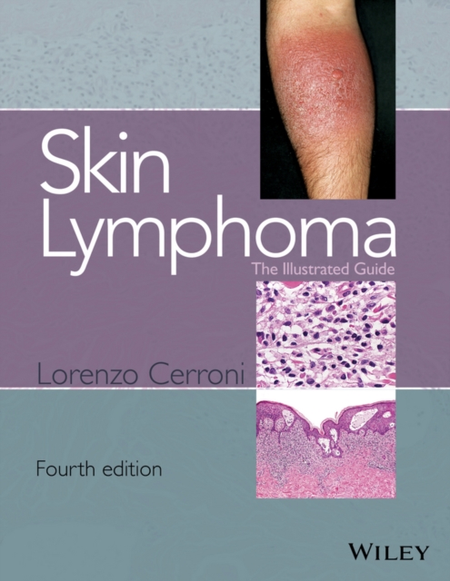 Skin Lymphoma : The Illustrated Guide, PDF eBook