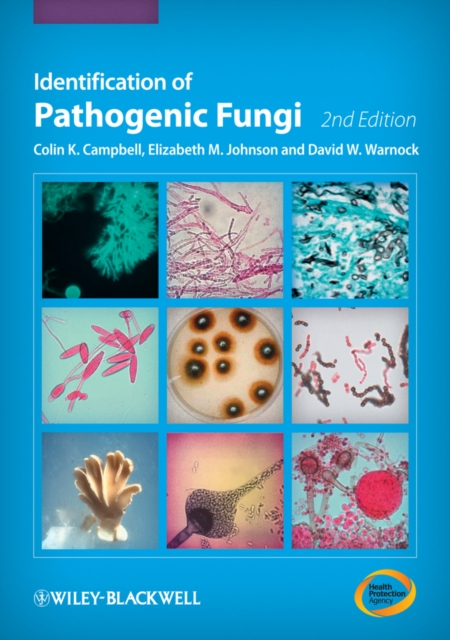 Identification of Pathogenic Fungi, EPUB eBook