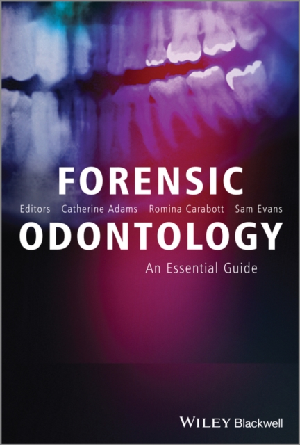 Forensic Odontology : An Essential Guide, PDF eBook