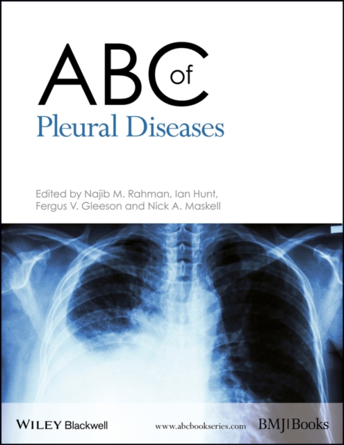 ABC of Pleural Diseases, EPUB eBook
