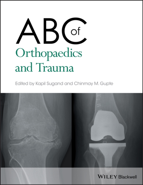 ABC of Orthopaedics and Trauma, Paperback / softback Book