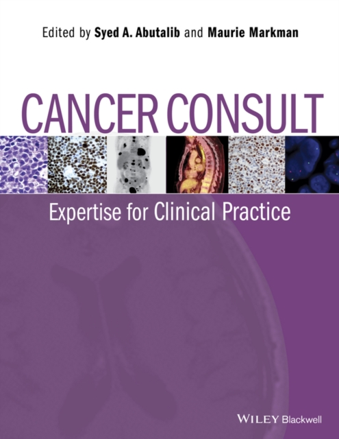 Cancer Consult : Expertise for Clinical Practice, PDF eBook