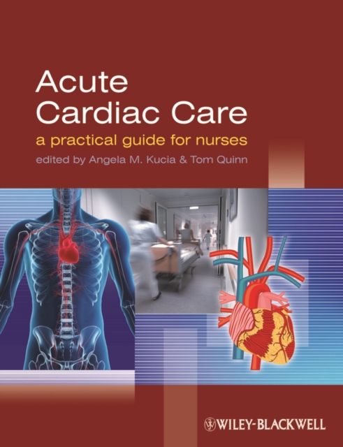 Acute Cardiac Care : A Practical Guide for Nurses, EPUB eBook