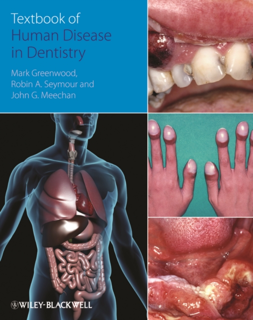 Textbook of Human Disease in Dentistry, EPUB eBook