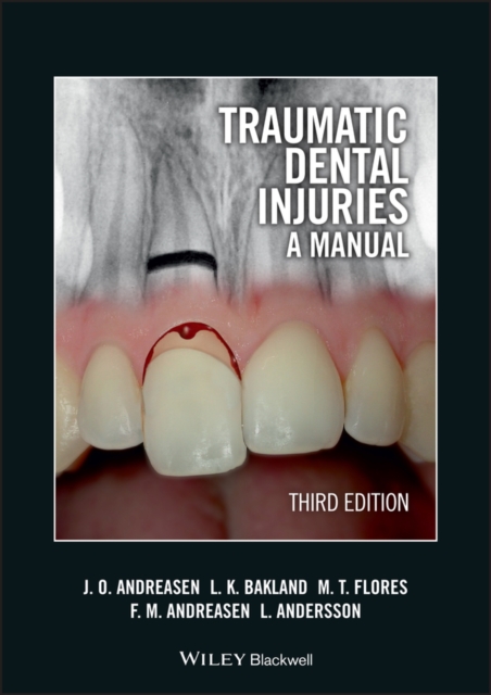Traumatic Dental Injuries : A Manual, PDF eBook