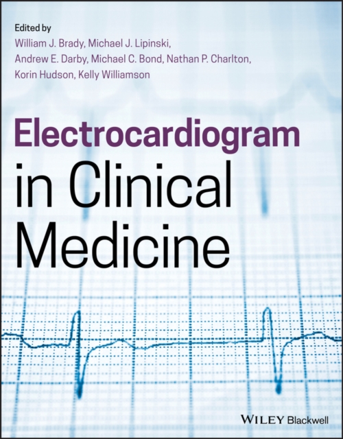 Electrocardiogram in Clinical Medicine, PDF eBook