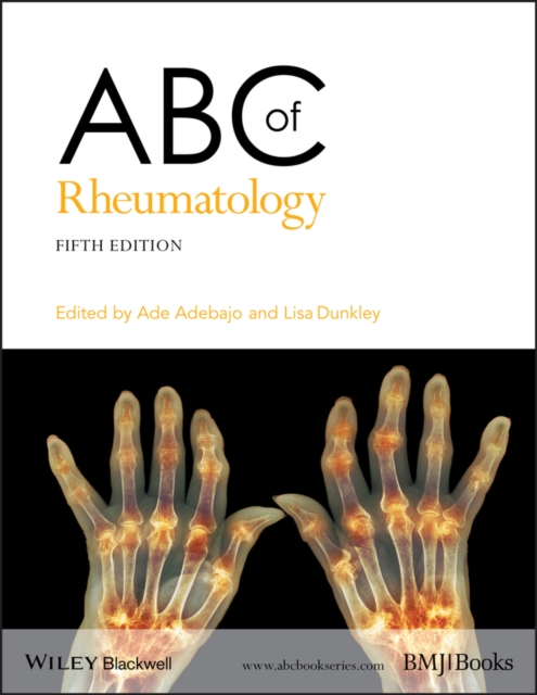 ABC of Rheumatology, PDF eBook