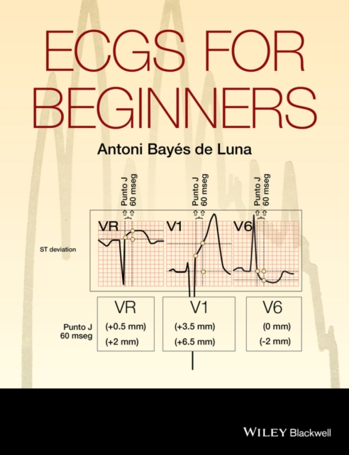 ECGs for Beginners, Paperback / softback Book