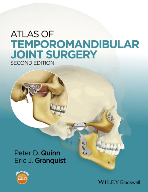 Atlas of Temporomandibular Joint Surgery, EPUB eBook