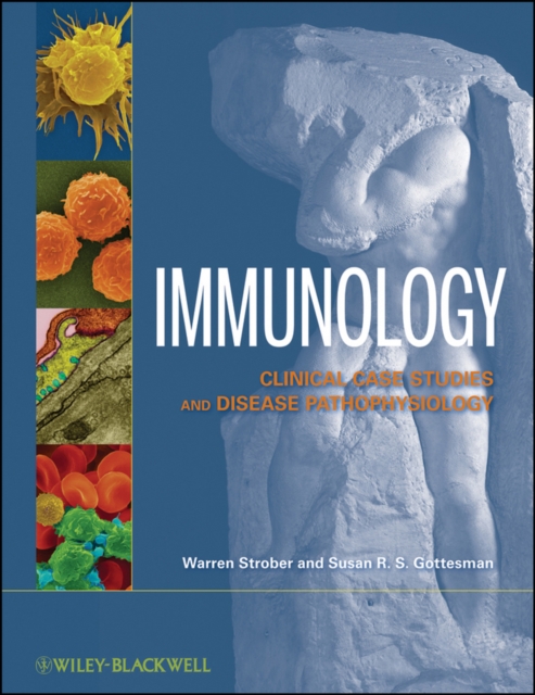 Immunology : Clinical Case Studies and Disease Pathophysiology, PDF eBook