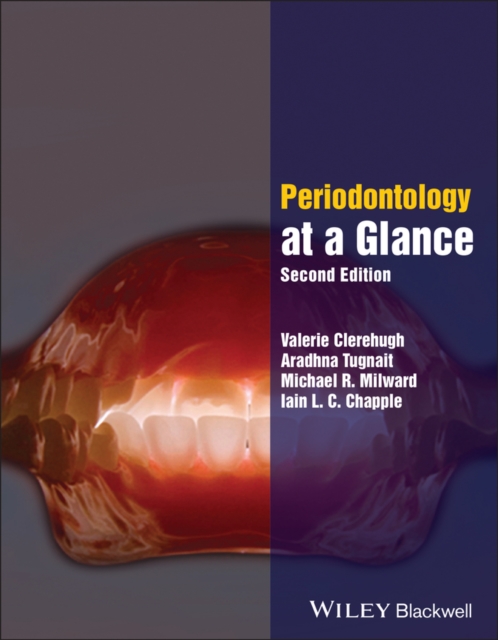 Periodontology at a Glance, PDF eBook