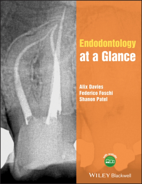 Endodontology at a Glance, Paperback / softback Book