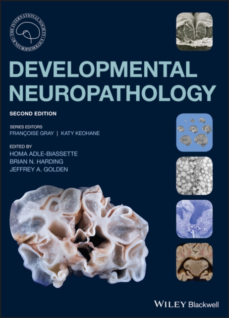 Developmental Neuropathology, PDF eBook