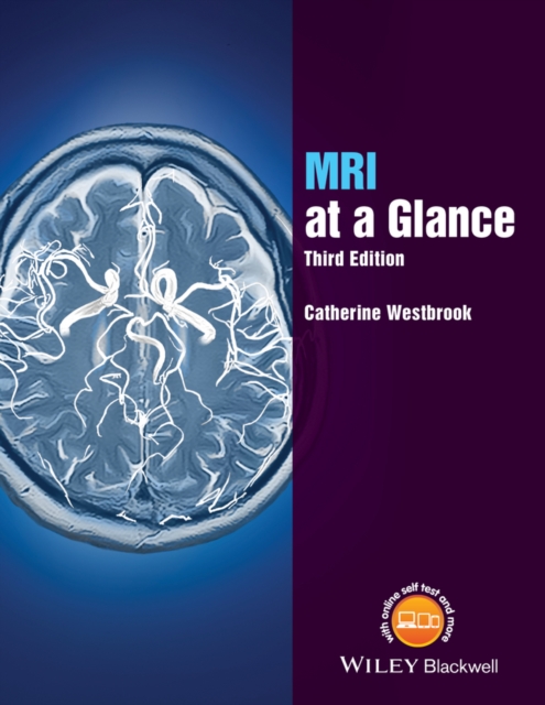 MRI at a Glance, EPUB eBook