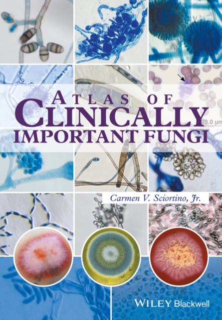 Atlas of Clinically Important Fungi, EPUB eBook