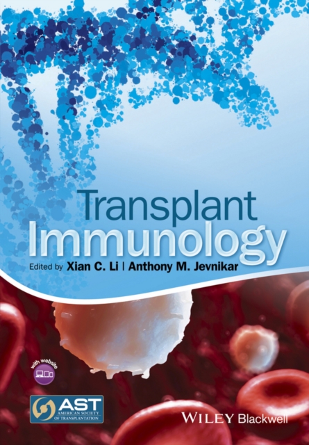 Transplant Immunology, PDF eBook