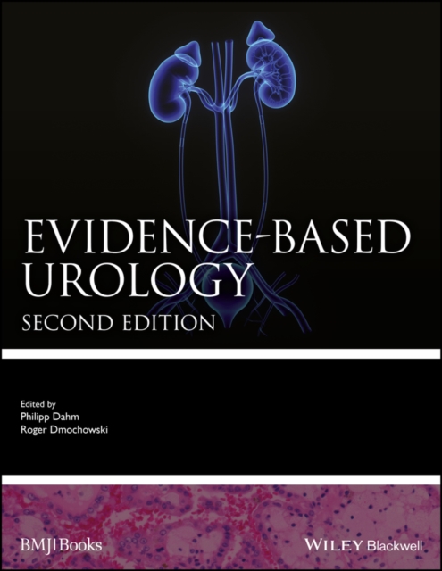 Evidence-based Urology, Hardback Book