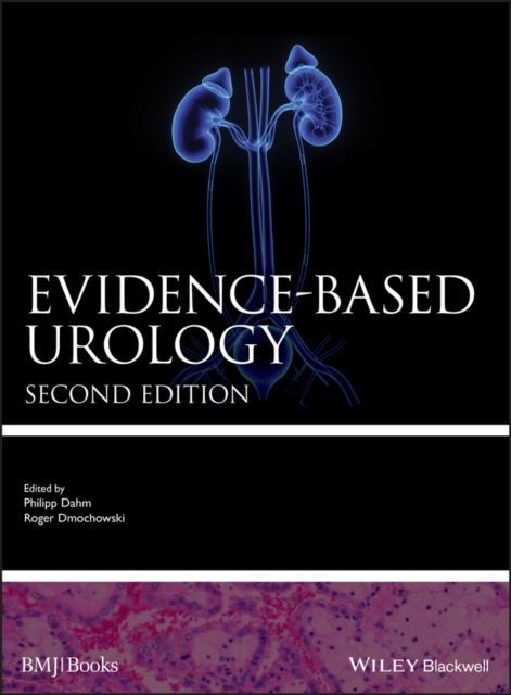 Evidence-based Urology, EPUB eBook