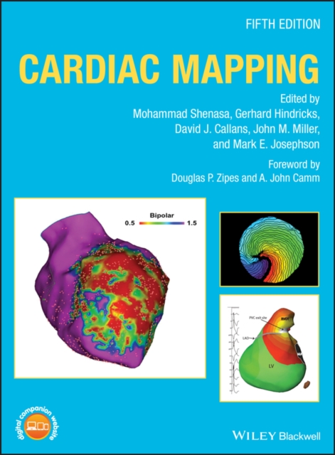 Cardiac Mapping, Hardback Book