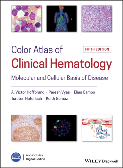 Color Atlas of Clinical Hematology : Molecular and Cellular Basis of Disease, PDF eBook