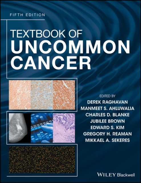 Textbook of Uncommon Cancer, Hardback Book
