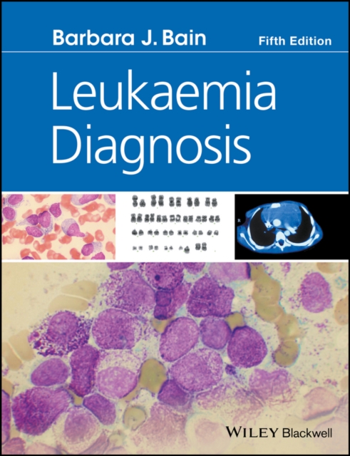 Leukaemia Diagnosis, PDF eBook