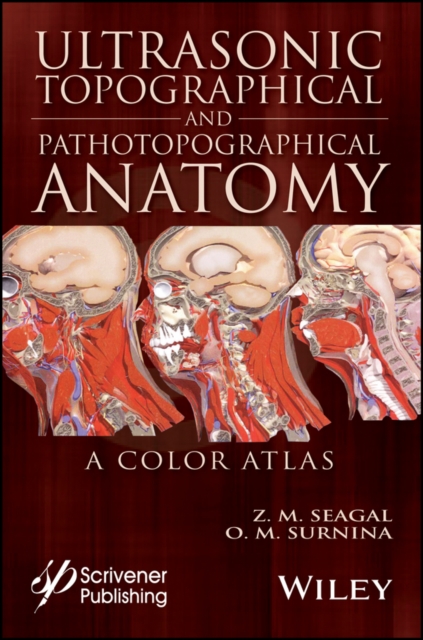 Ultrasonic Topographical and Pathotopographical Anatomy : A Color Atlas, Hardback Book